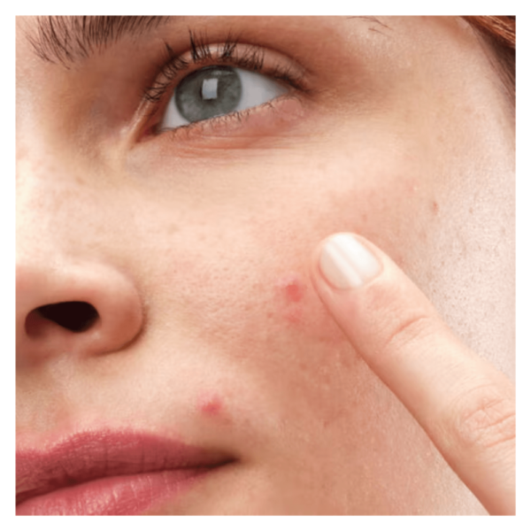 Concentrado Antiacne The Ordinary Sulfur 10% Powder-to-Cream   combate espinhas rápido - Imagem 8