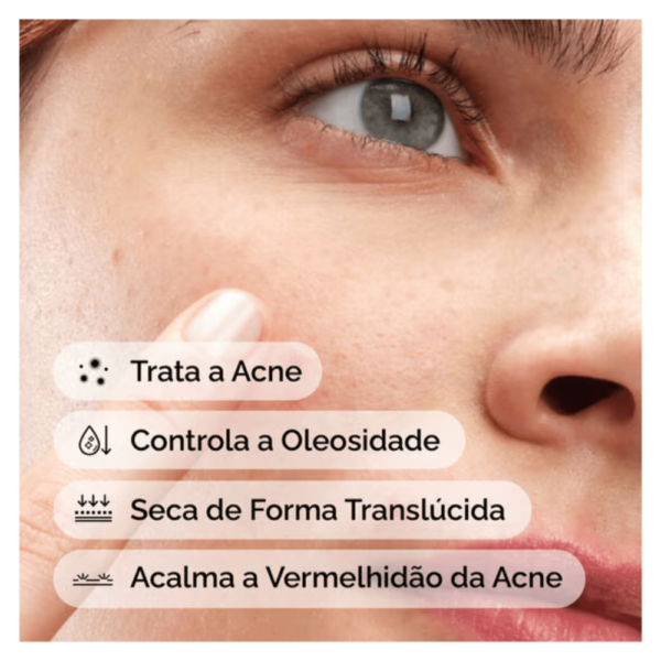 Concentrado Antiacne The Ordinary Sulfur 10% Powder-to-Cream   combate espinhas rápido - Imagem 2