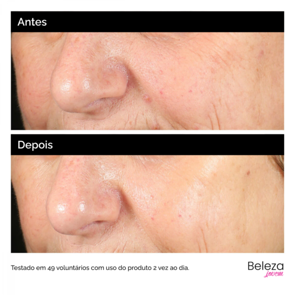 The Ordinary Alpha Arbutin 2% + HA 30ml Clareador de Manchas - Imagem 5